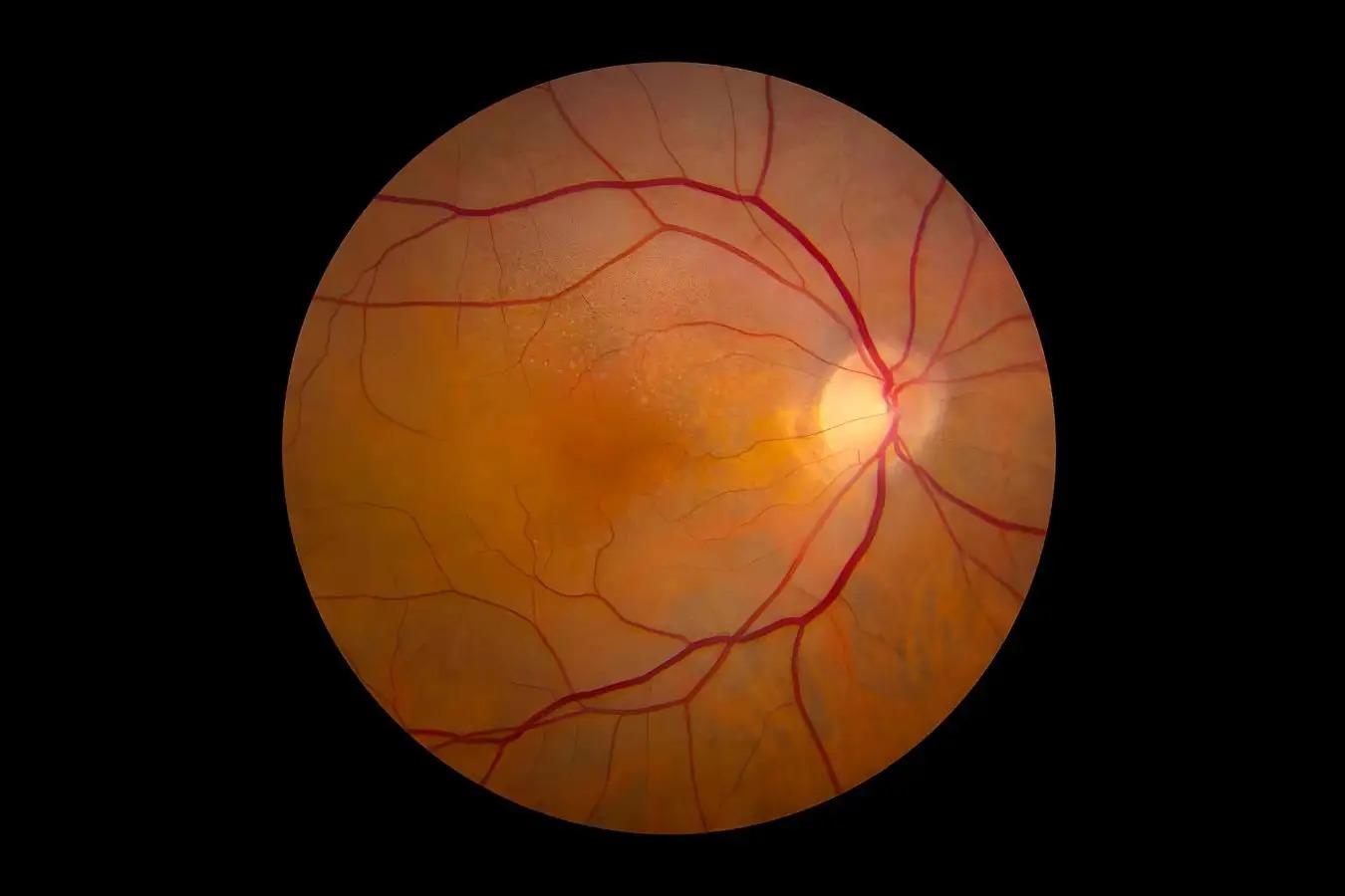 Tellurium nanowire retinal nanoprosthesis improves vision in models of blindness
